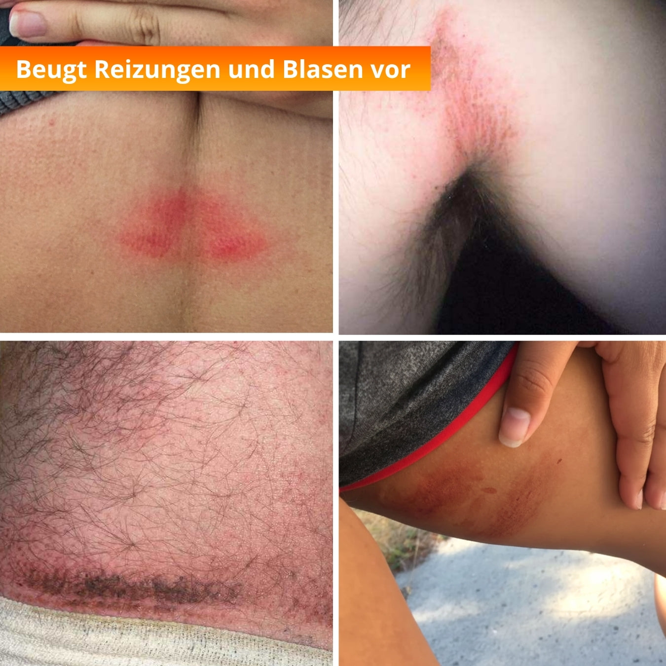 Anti-Reibung Balsam - 50ml